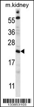 TTC33 Antibody