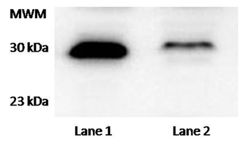 TTC33 Antibody