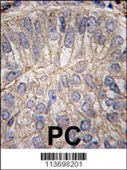 CDH3 Antibody (C-term)