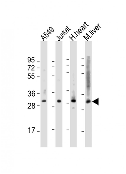 ATF5 Antibody (C-term)