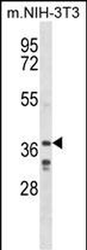 LHX6 Antibody (C-term)