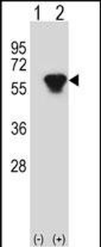 PRKAR2B Antibody (Center)