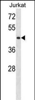 STK33 Antibody (N-term)