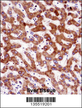 IHH Antibody (N-term)