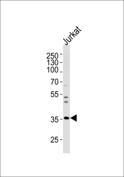 GLRB Antibody (N-term)