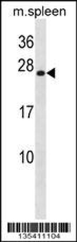 Mouse Hoxb7 Antibody (Center)