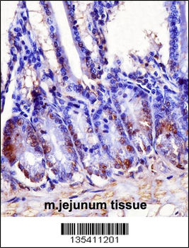 Mouse Hoxb7 Antibody (Center)