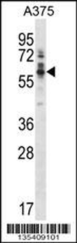 Mouse Ptk6 Antibody (N-term)