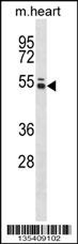 Mouse Ptk6 Antibody (N-term)