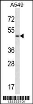 UTS2R Antibody (Center)