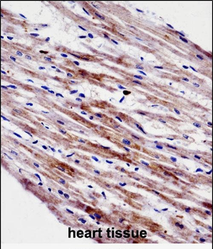 CTF1 Antibody (C-term)