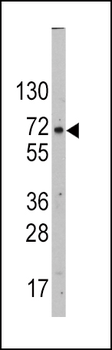 GLUT2 (SLC2A2) Antibody (N-term)