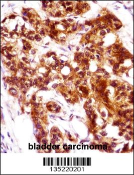 KRT7 Antibody (N-term)