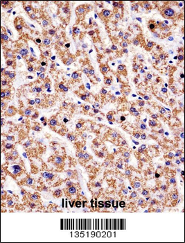 HYAL1 Antibody (C-term)