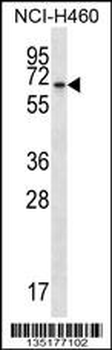 BEND4 Antibody (N-term)