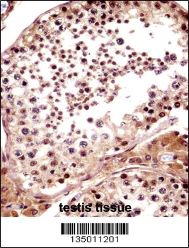 TNKS Antibody (N-term)