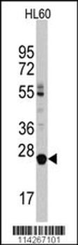 LIN28B Antibody (C-term)