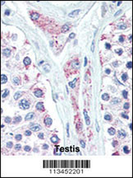 LIN28B Antibody (N-term)