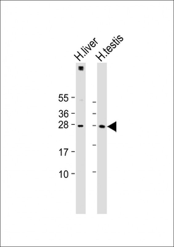 LIN28B Antibody (N-term)
