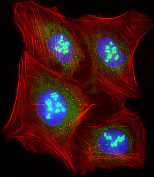 LIN28B Antibody (N-term)