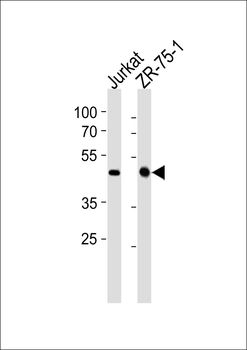 ECSIT Antibody (C-term)