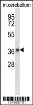 PAQR8 Antibody (C-term)
