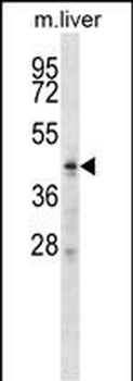 ZDHHC6 Antibody (C-term)