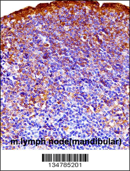 Mouse Gsk3a Antibody (C-term)
