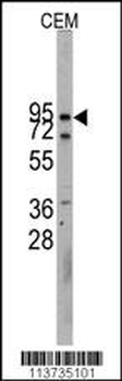 CDH10 Antibody (N-term)