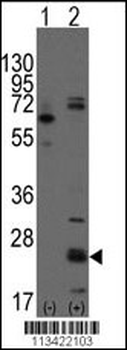 CD9 Antibody (N-term)