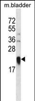 LY86 Antibody (C-term)