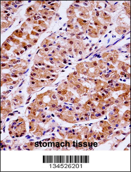 KLK15 Antibody (Center)