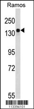 BDP (ARID3B) Antibody (C-term)