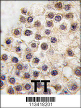BDP (ARID3B) Antibody (C-term)