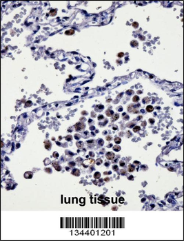 CYSLTR1 Antibody (Center)