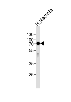 Alkaline Phosphatase (ALPI) Antibody (Center)