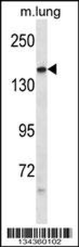 PTPRG Antibody (Center)