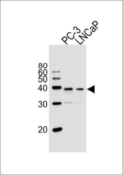 VDR Antibody (Center)