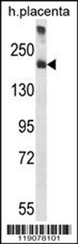 A2M Antibody (C-term)