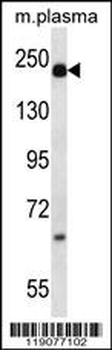 A2M Antibody (N-term)