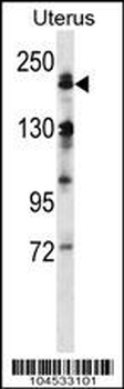 MEKK4 Antibody (Center C1081)