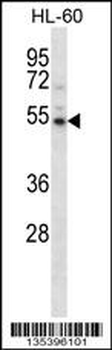 Mouse Camkv Antibody (N-term)