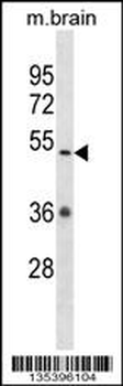 Mouse Camkv Antibody (N-term)