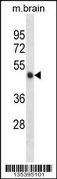 Mouse Camk2a Antibody (C-term)