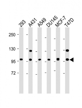 E Cadherin (CDH1) Antibody (N-term)