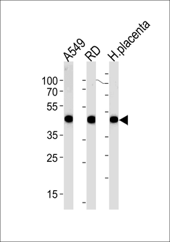 ACTA1/Alpha-actin Antibody (C-term)