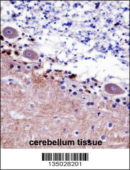 SEPT5 Antibody (N-term)