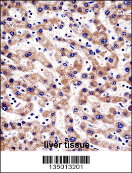 HTATIP2 Antibody (N-term)