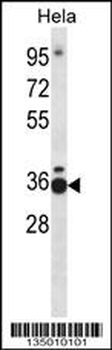 TCEA1 Antibody (Center)
