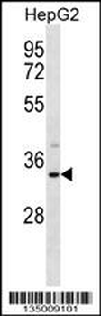 SULT1A3 Antibody (Center)
